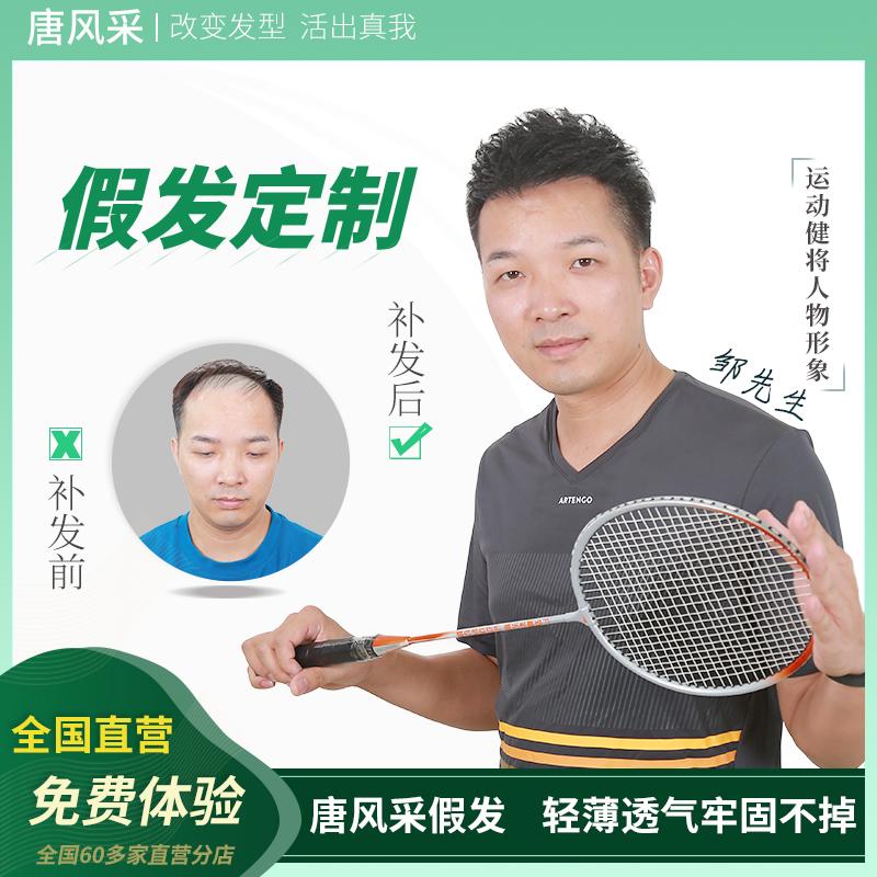 宁波唐风采怎么样？头发稀疏怎么解决？