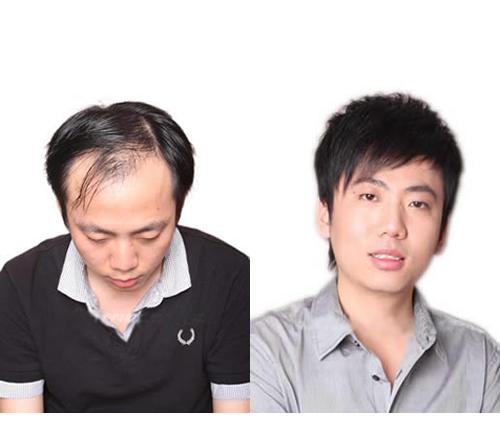 西安黑黛补发怎么样