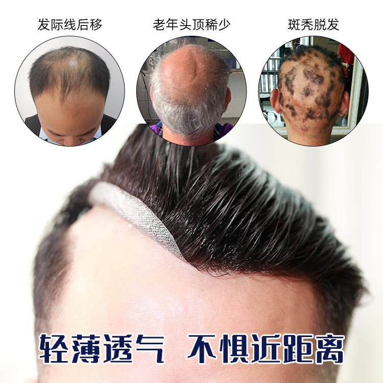 唐风采补发多少钱？织发补发的过程是怎样的？