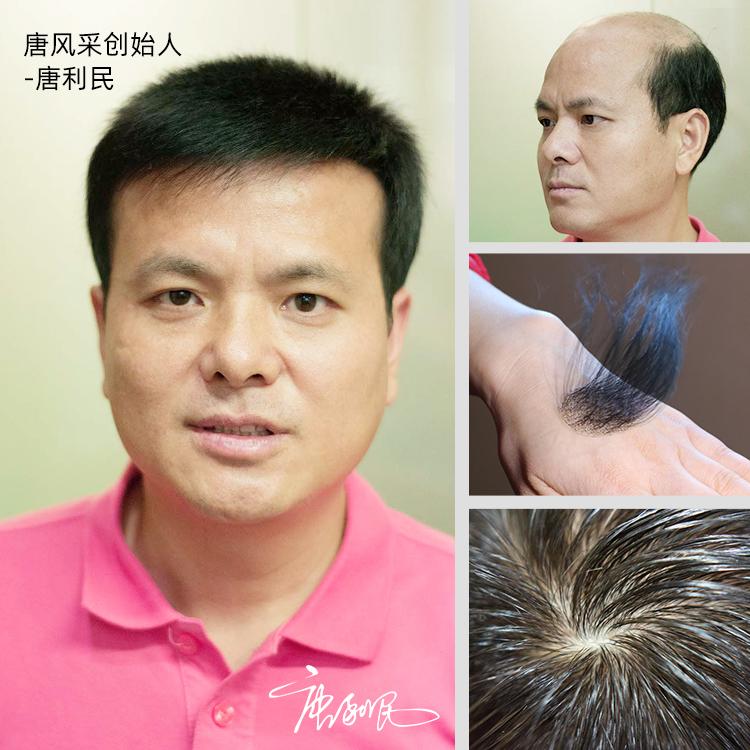 唐风采的假发多少钱一个