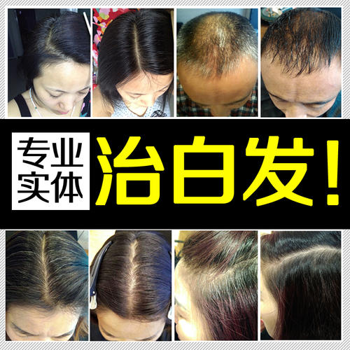 唐风采治白发要多少钱