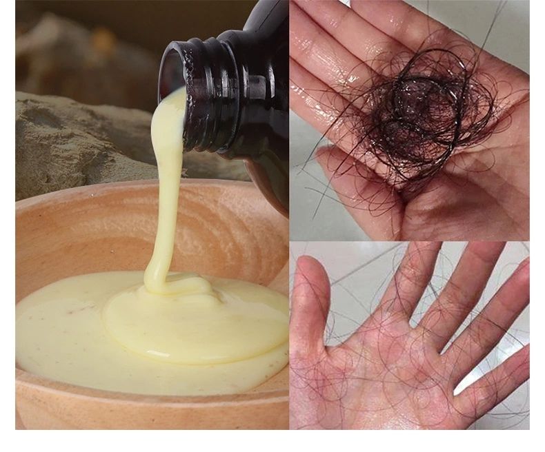 生发洗发水有用吗？植发的危害是什么？