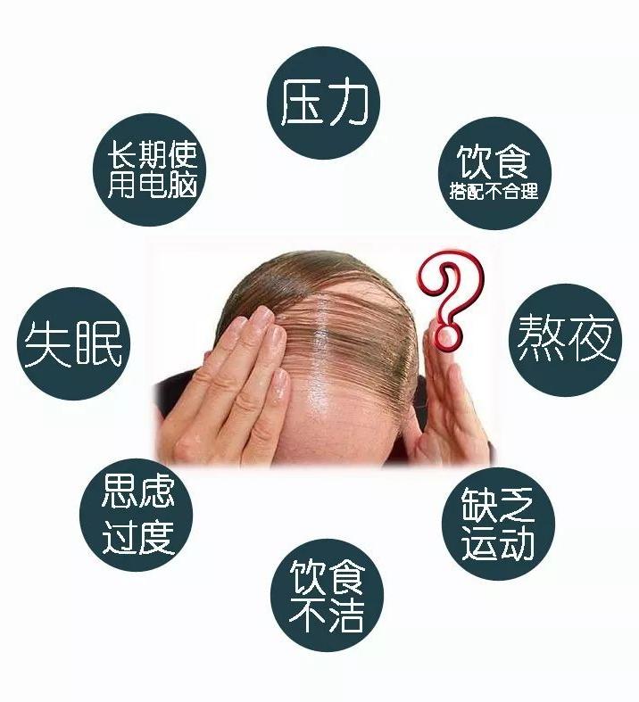 什么药物生发效果最好