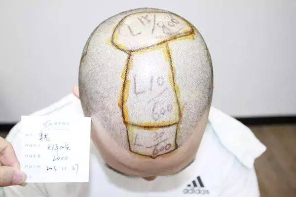 唐风采织发多少钱?织发和假发有哪些区别
