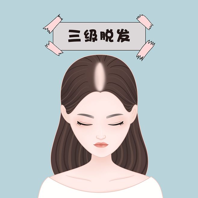 植发卡通