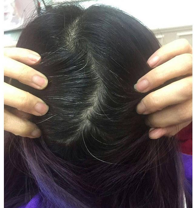 广唐风采白发变黑发多少钱？白发变黑怎么办？