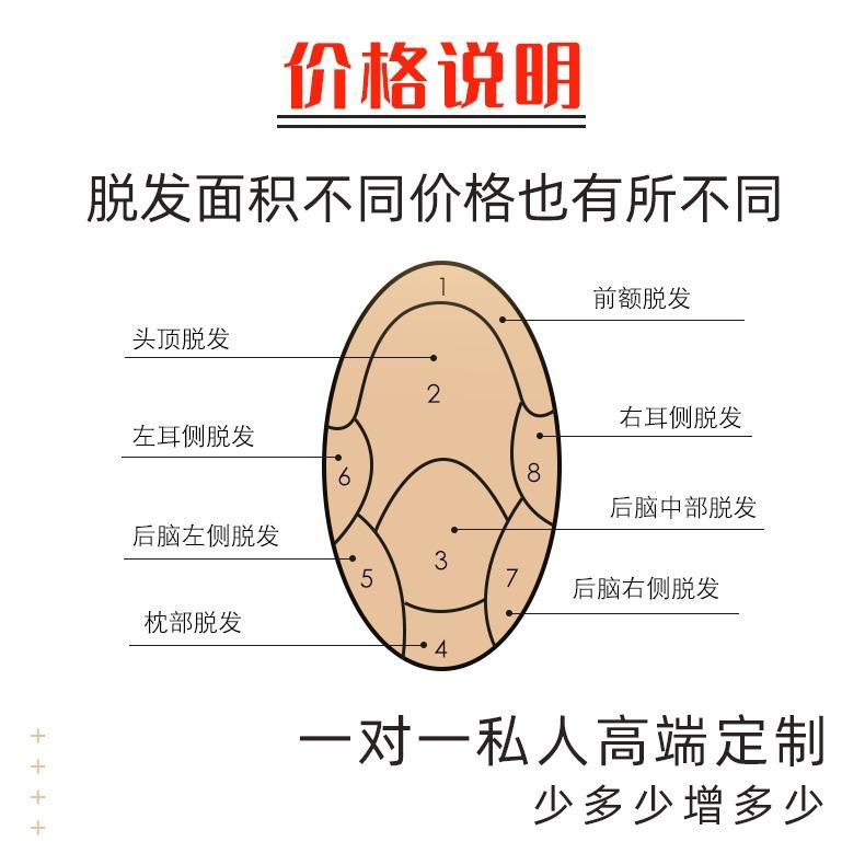 唐风采男士假发多少钱？唐风采假发优点有哪些？