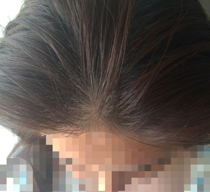 黑黛增发服务有限公司怎么样？脱发吃什么好？