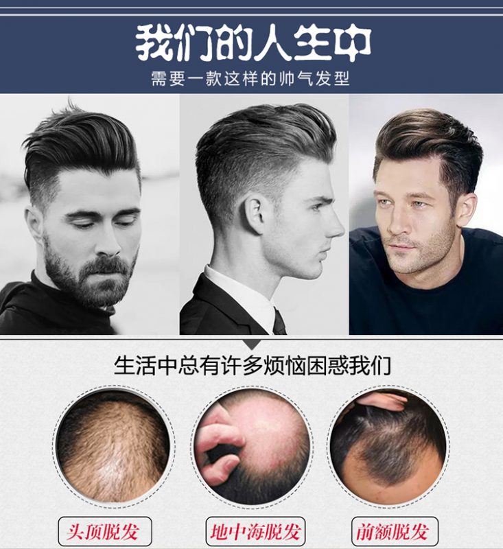 脱发1-7级程度图片是怎样的？脱发的治疗方法有哪些？