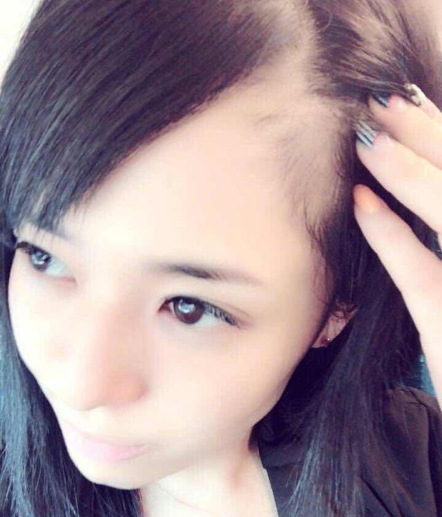 生发产品哪个效果好百度知道