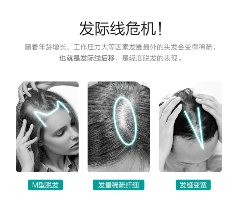 快速生发，生发什么牌子的产品好，如何选择生发产品