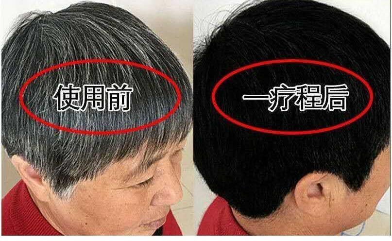 优雅黛白转黑洗发水怎么样