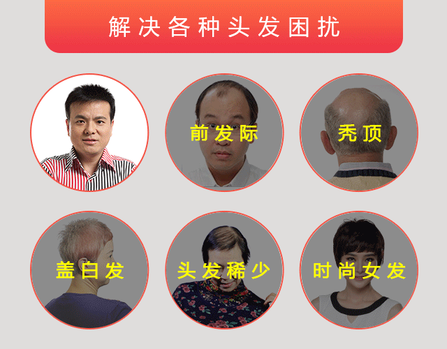 唐风采做一顶假发要多少钱