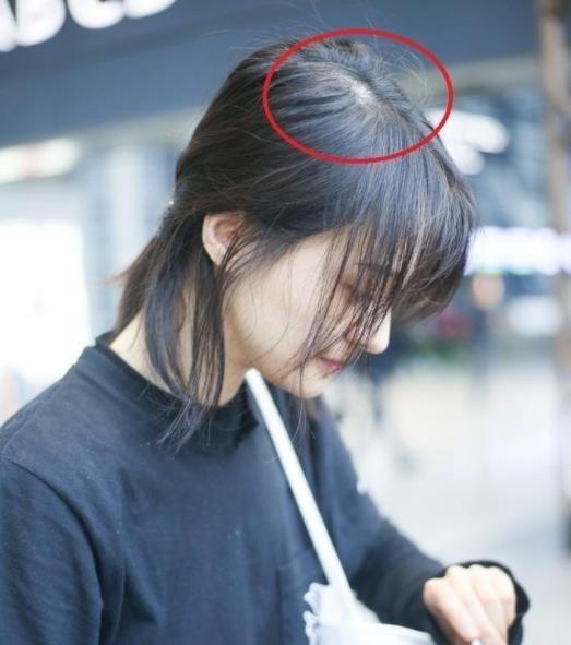 目前最靠谱的生发产品