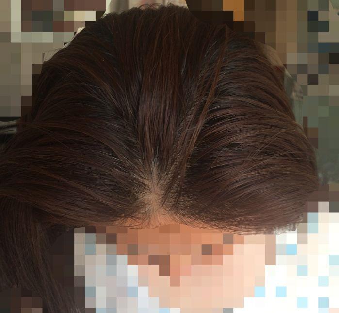 黑黛增发(广州天河店)怎么样？增发是不是要剃光头？