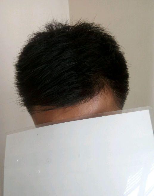 黑黛增发怎么样 论坛坛