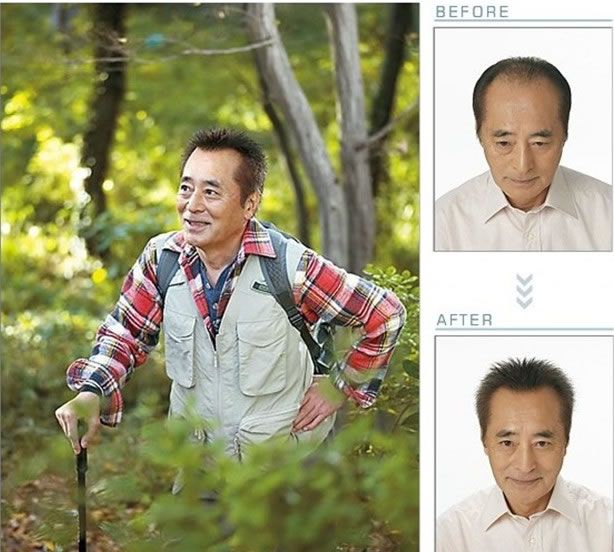 你去唐风采花了多少钱？什么牌子的假发好？