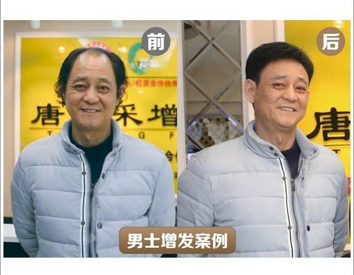 唐风采假发多少钱？做假发到哪里好？