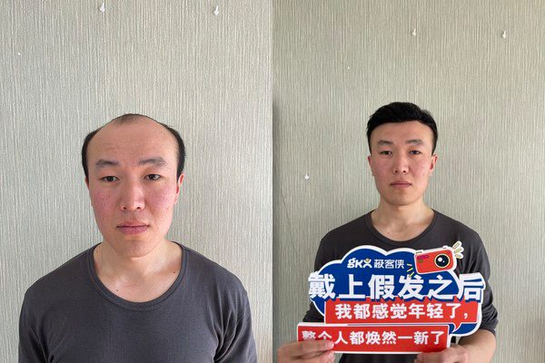 珠海极客隐形无痕补发好吗？（过来人这样评价）