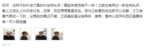 这样子的补发才真的叫生物头皮!摸起来感觉就不一样