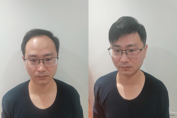 二十多岁年纪却有着四十多岁的烦恼