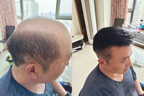 极客补发好还是大象补发好？
