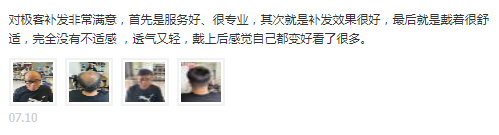 服务好、很专业,其次就是补发效果很好