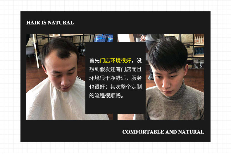 生物头皮假发多少钱？