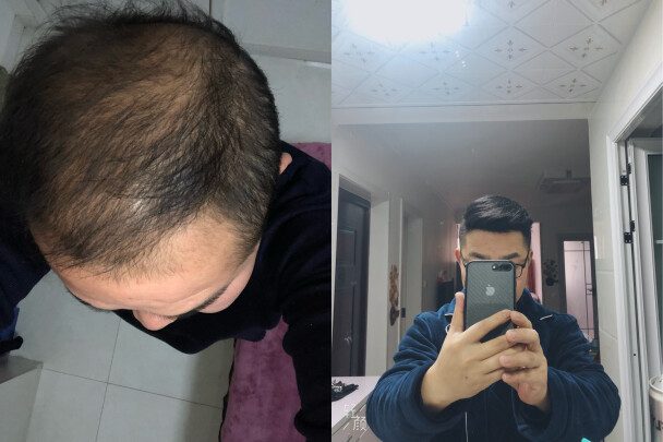 薄一补发和极客补发哪个好？