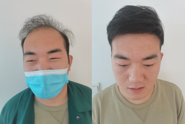 透气性很好,真头发做的,很结实