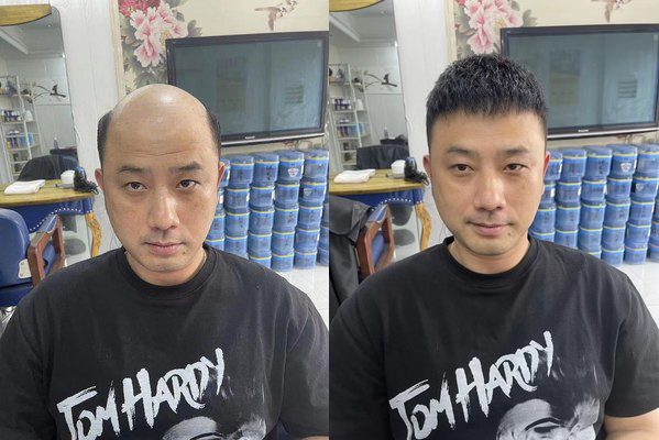 宁波鄞州假发在哪买好？