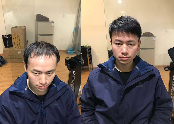 济南什么地方做假发好？