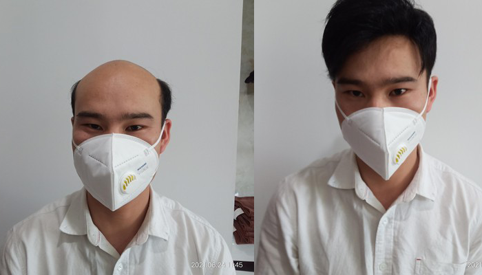 衡阳假发定制哪家好？