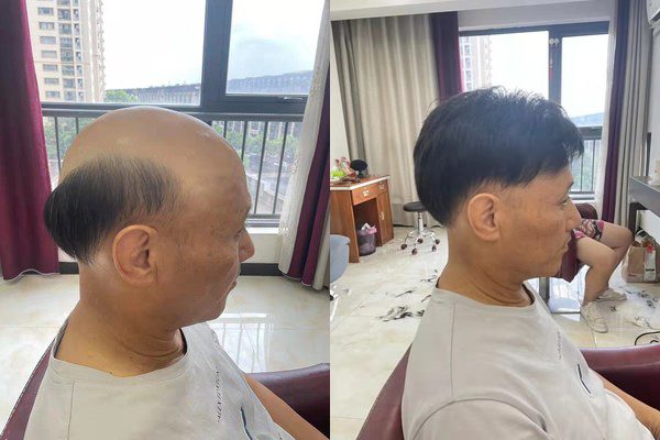 西安做假发的地方在哪？