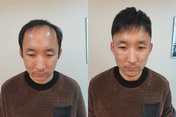 生物头皮都是正品,佩带体验5颗星