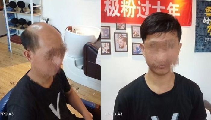 戴上之后根本看不出来