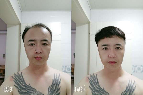 合肥哪里有卖假发的？