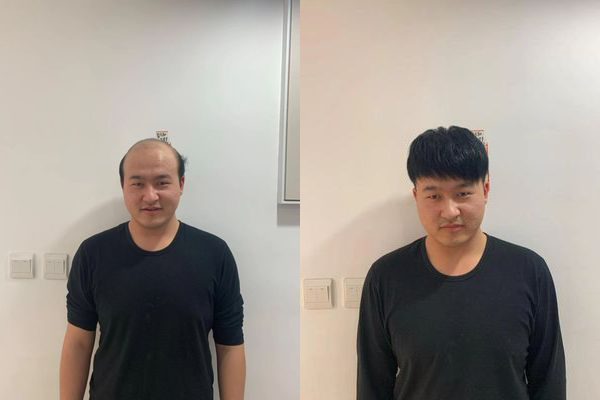 上海哪里有定制假发？（上海假发定制推荐）
