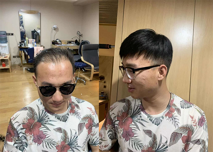 宁波哪里有做假发的？