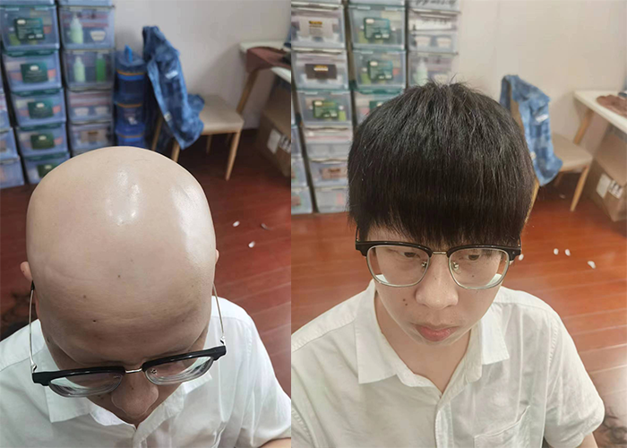 假发佩戴效果很好