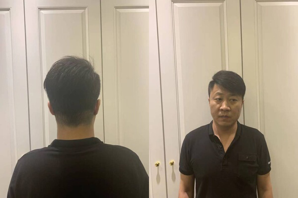 西宁哪有买假发的地方？