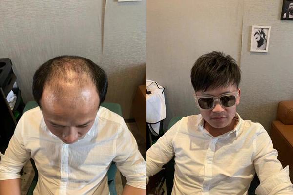 桂林假发定制哪家好？