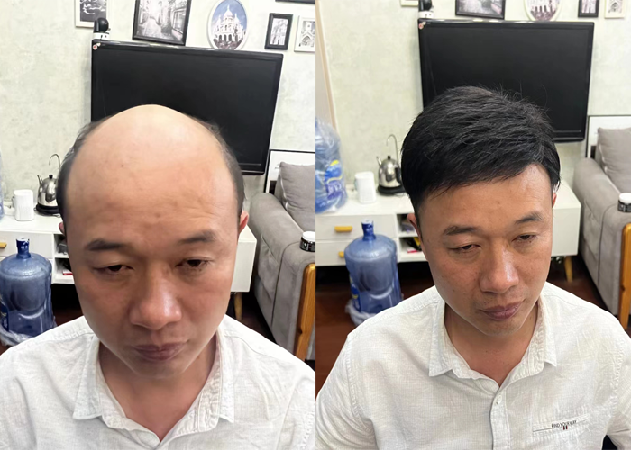 温州假发定制哪家最好？