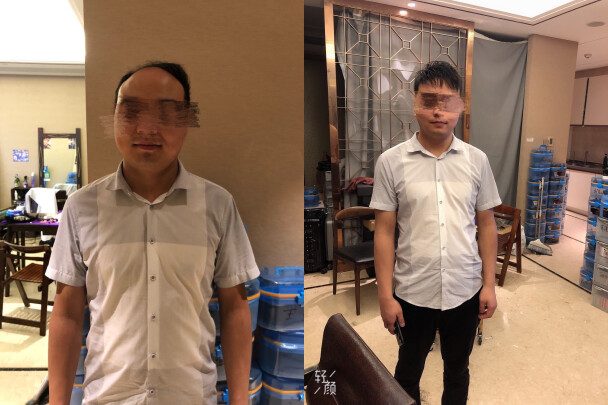 无锡假发定制哪家好？（内含推荐）