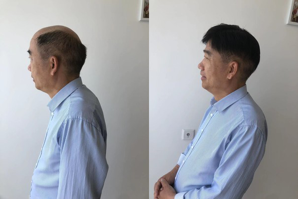 过程透明,交流诚恳,假发质量与价格符合