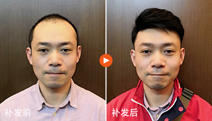 极客侠假发定制效果