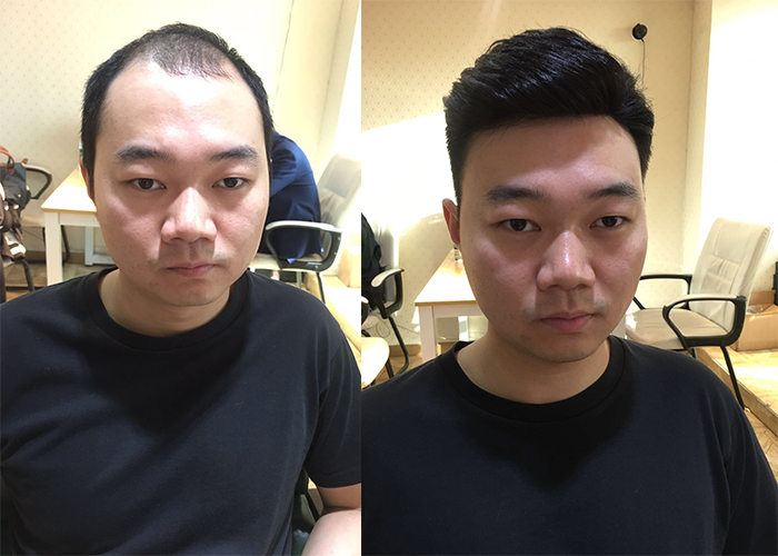 南京哪家可以定制假发套？