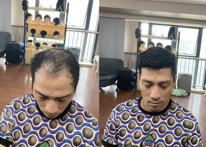 沈阳补发哪家好？（沈阳补发推荐）
