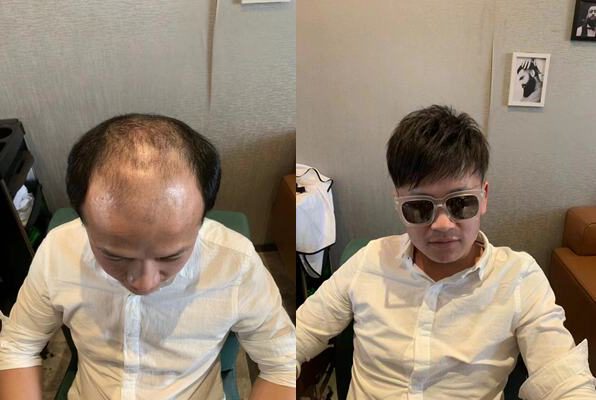 海口哪里可以做假发？（地址分享）
