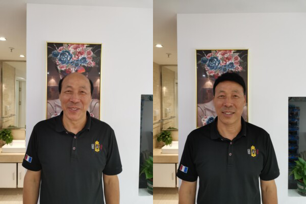 济南哪里有卖假发的？（济南卖假发的地址推荐）